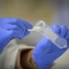 Coronavirus, tamponi salivari più efficaci dei test naso-faringei: l’Università di Padova prepara la versione “rapida”