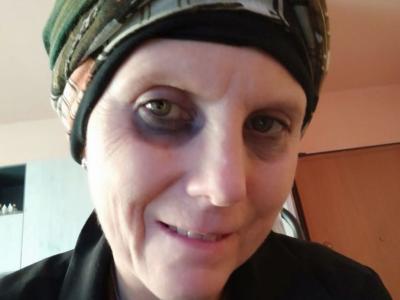 Milano, malata di cancro cerca e trova la madre biologica per curarsi: la donna si rifiuta di aiutarla