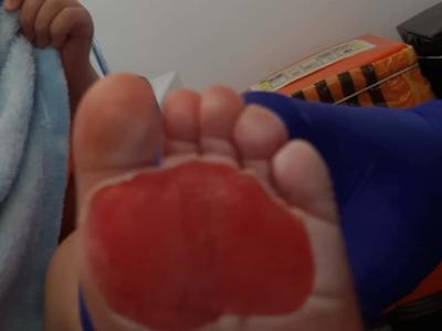 Caldo eccezionale, bimbo si brucia i piedini nudi sul pavimento della cucina, madre ancora sotto shock