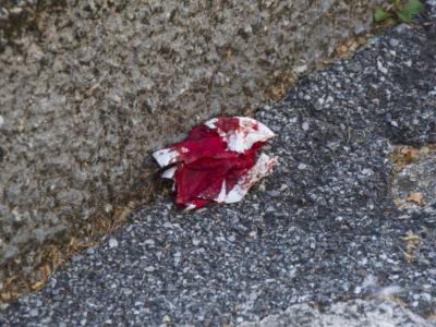 Terrore a Riccione, un ragazzo inseguito da una banda si rifugia in un albergo che poi viene distrutto