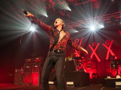 Piero Pelù cade dal palco dell’Alcatraz e mostra la lastra del cranio e le lesioni avute: “Il segno del rock’n’roll” (VIDEO)