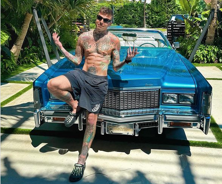 Fedez e la sua nuova immagine di pesce palla sfoggiata alle belve funzionano, anche troppo